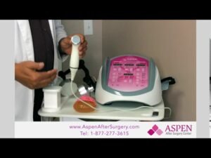 Ultrasound treatment for capsular contracture 